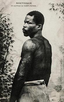 Louis Auguste Cyparis - felon survivor