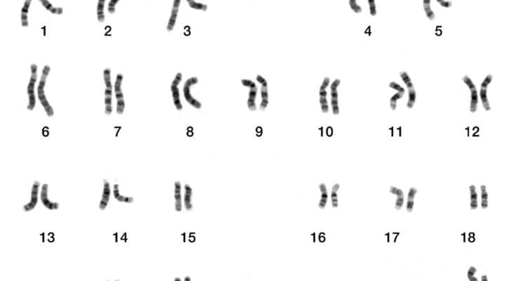 what are chromosomes