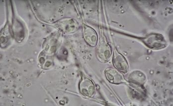 They’ve Found the First-Ever Animal that Doesn’t Need Oxygen