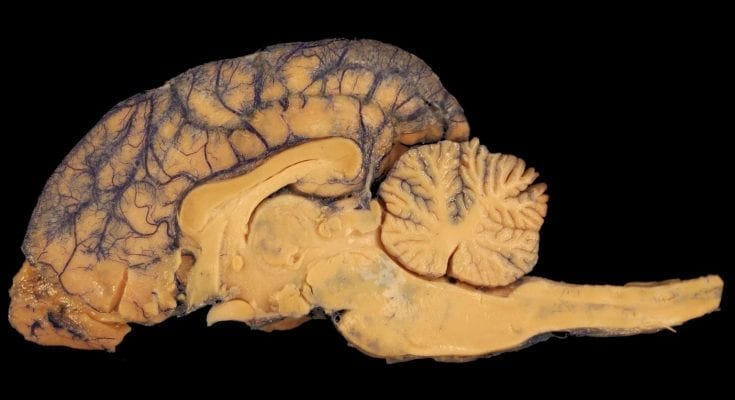 interesting facts about human brain