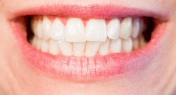 Is it Worth Getting Your Teeth Whitened at the Dentist?