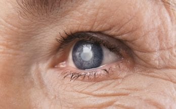 A Brief History of Glaucoma Treatment