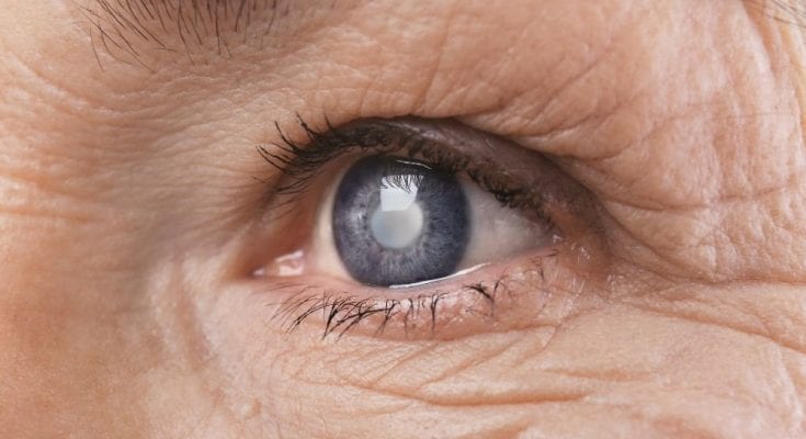 A Brief History of Glaucoma Treatment