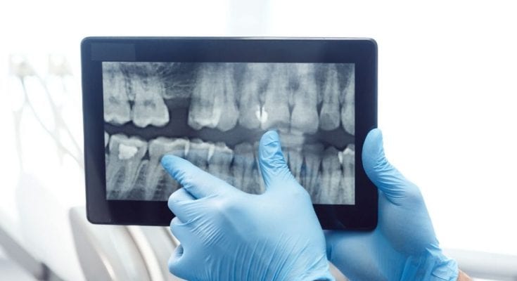 Different Types of X-Ray and How They Are Used