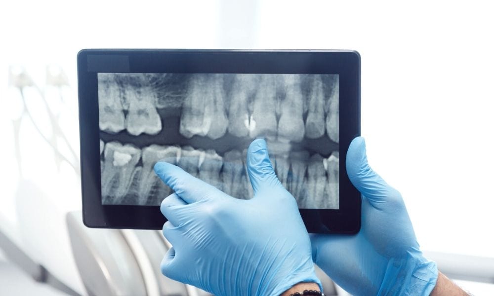 Different Types of X-Ray and How They Are Used