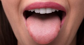 How To Know You’re a Supertaster