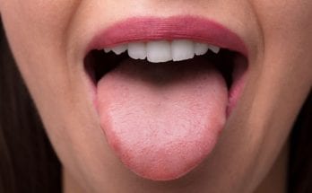 How To Know You're a Supertaster