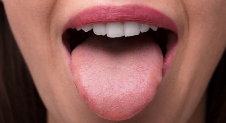 How To Know You're a Supertaster