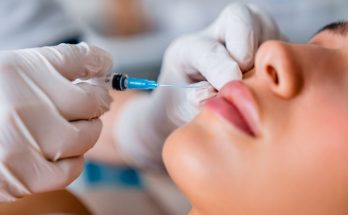 5 Interesting Things You Didn’t Know About Botox