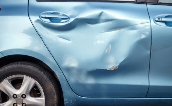 Why You Should Fix Car Dents Immediately