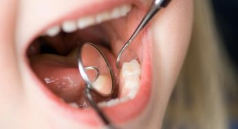 How To Get Rid of Dental Plaque