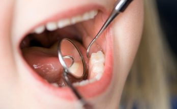 Get Rid of Dental Plaque
