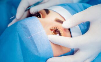 Common Eye Surgeries