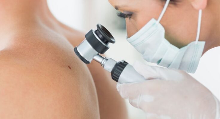 Skin Tumors: Medical Surgeries for Skin Cancer