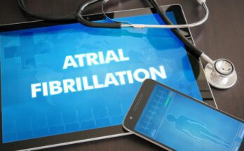 How to Stop an AFib Episode