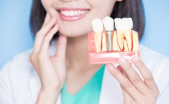 Bone Graft for a Dental Implant