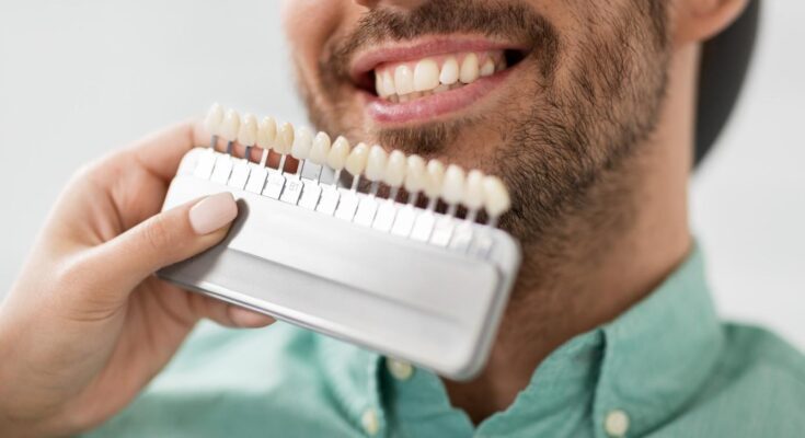 Pros and Cons of Getting Fake Teeth