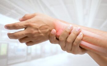 Causes of Wrist Popping