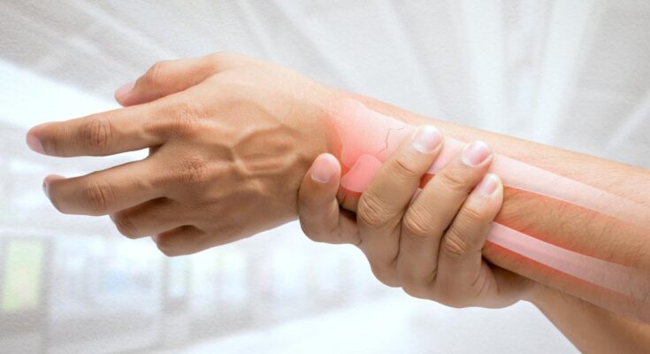 Causes of Wrist Popping