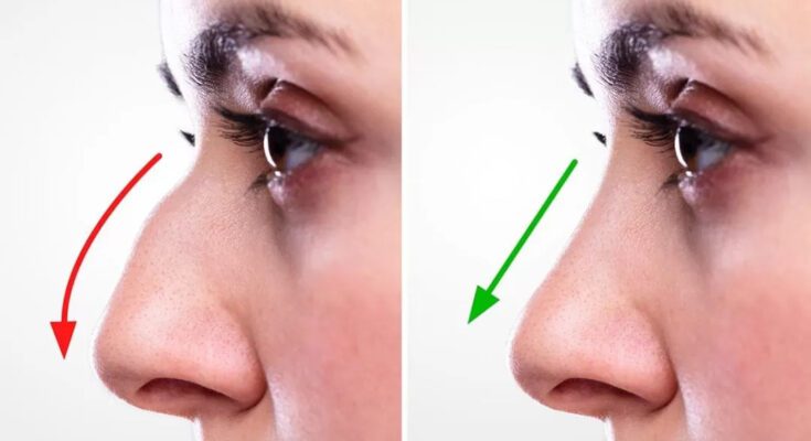 Rhinoplasty in Dubai