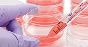 5 Key Factors That Impact Cell Culture Success