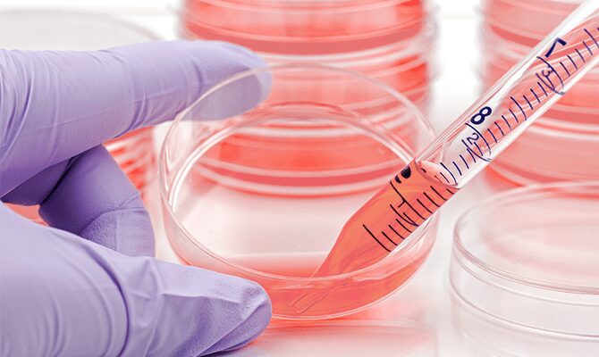 Key Factors That Impact Cell Culture Success
