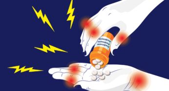 5 Interesting Facts to Know About Taking Prednisone