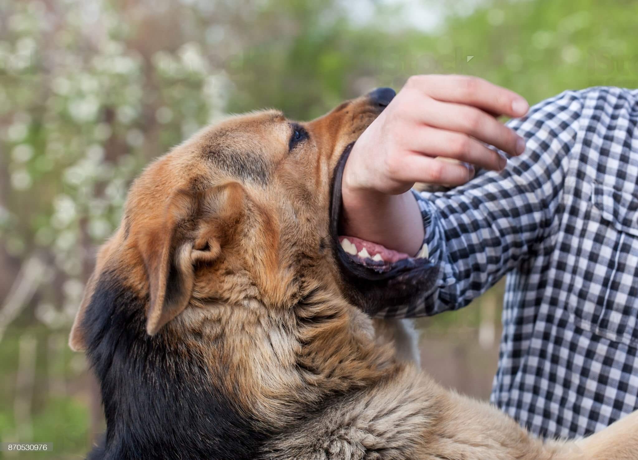 Compensation Process For Dog Bite Scars 