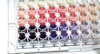 What Are the Main Types of Immunoassays?