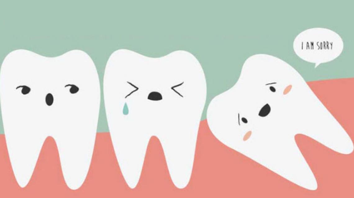 Truth About Third Molars