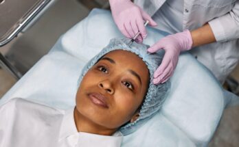Things You Should Consider Before Getting a Facelift