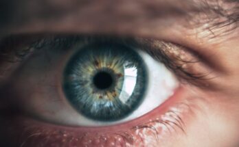 How to Improve Your Vision If You Have Cataracts