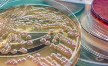 An up close petri dish with red agar gel in the contents. The agar gel is forming red bubbles for cell culture testing.
