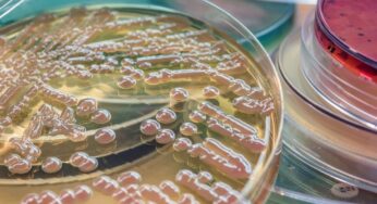 How Agar Is Used in Medical Laboratories